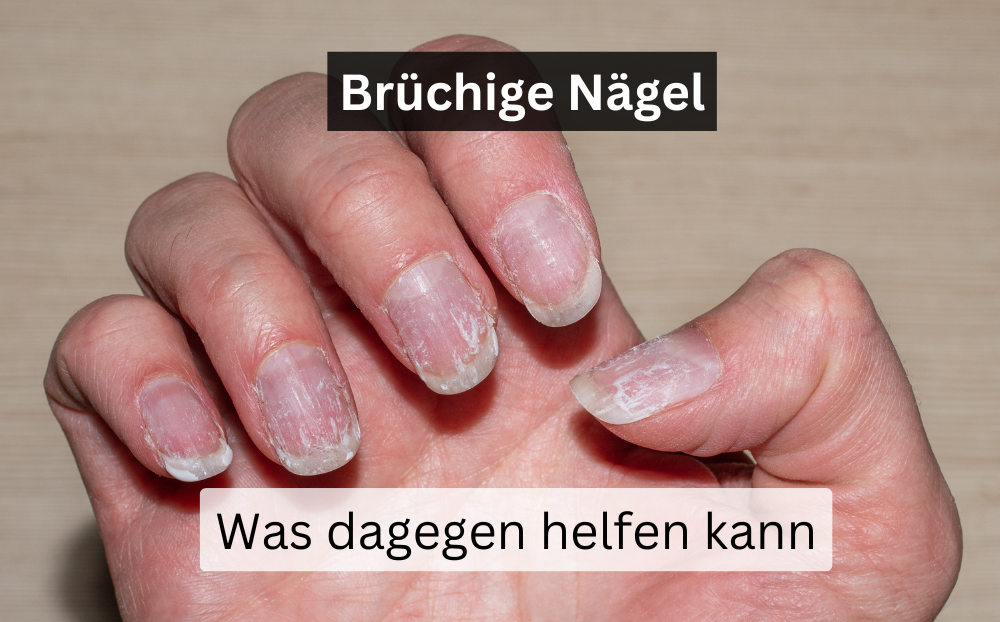 Brüchige Nägel