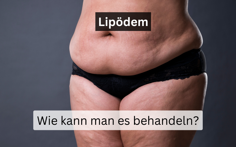 Lipödem